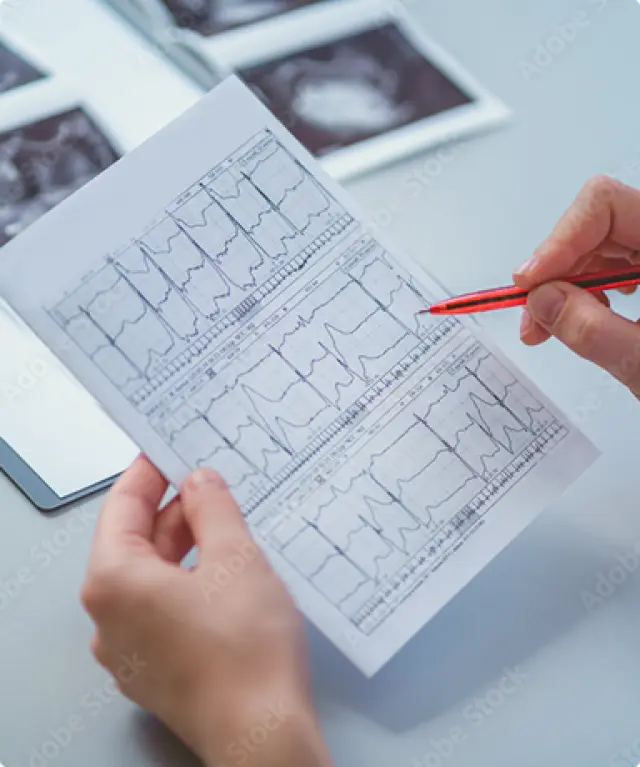 Kardiologische  Funktionsdiagnostik
